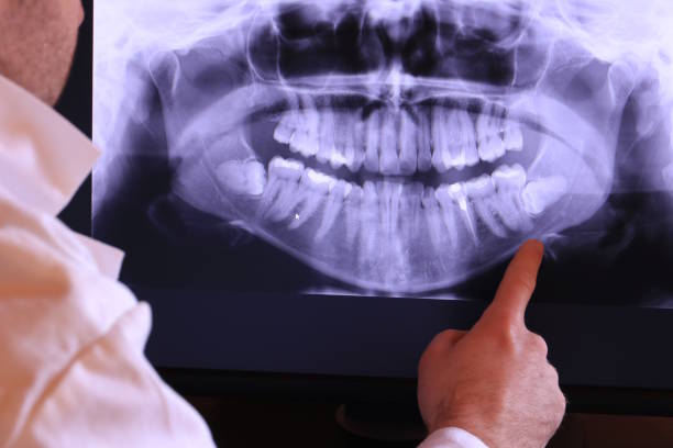 Best Emergency Dental Services Near Me  in Shorewood Tower Hills Harbert, MI